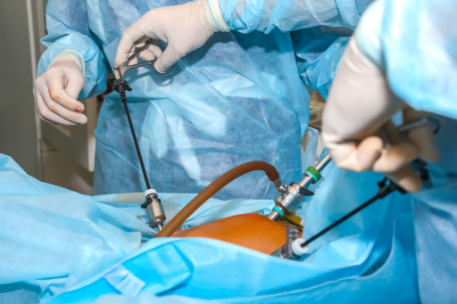 Best Laparoscopic Surgery Hospital in Patna