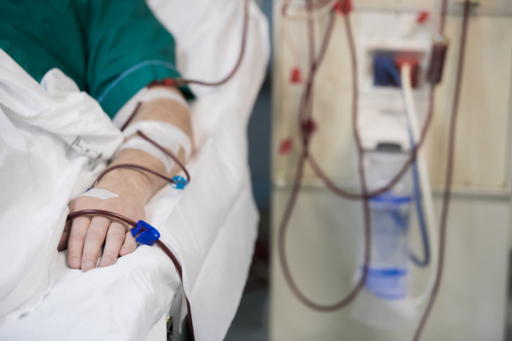 Top Nephrology and Dialysis Hospital in Patna